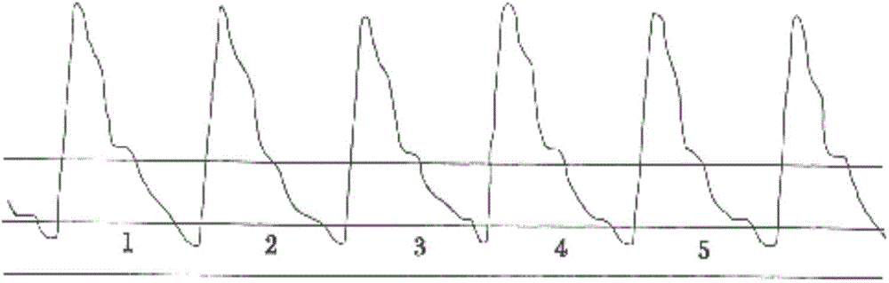 本发明提出一种脉搏检测控制方法,通过设定脉搏曲线图中的确定点,再