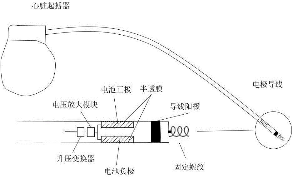 cn110124197a_一种生物燃料电池供电的无导线心脏起搏器在审