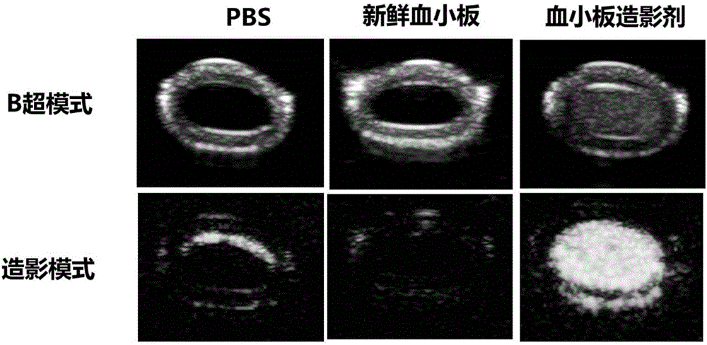 cn110269946a_天然细胞膜衍生的新型超声造影剂的制备及其应用在审