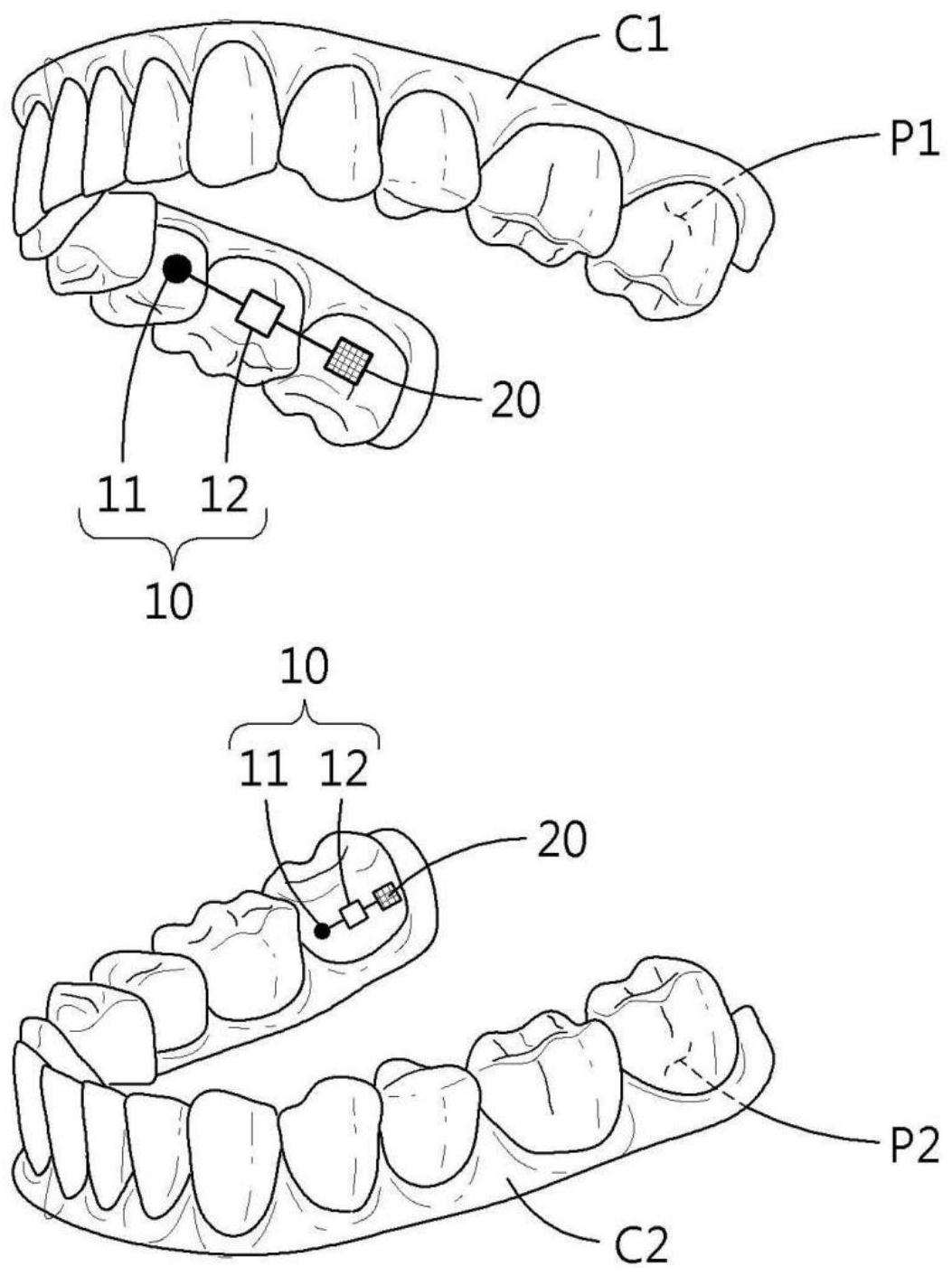 cn111685908a_牙齿附着用可穿戴式设备和牙齿固定用感应设备