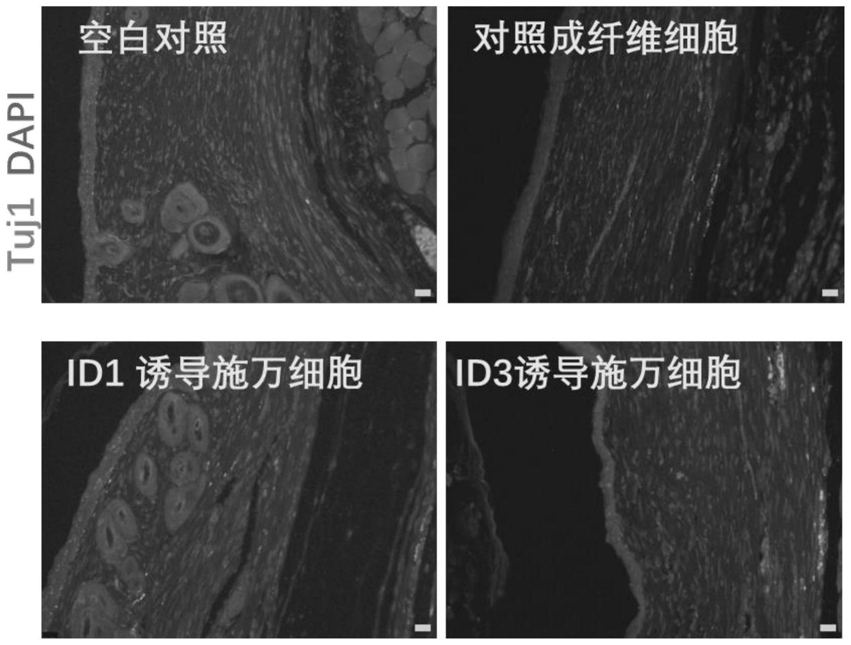 id1/id3在诱导成纤维细胞重编程为施万细胞促进神经再生的应用