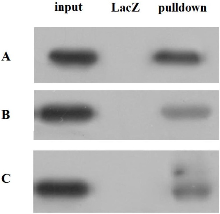 cn106168625b_一种rna pulldown方法及试剂盒有效