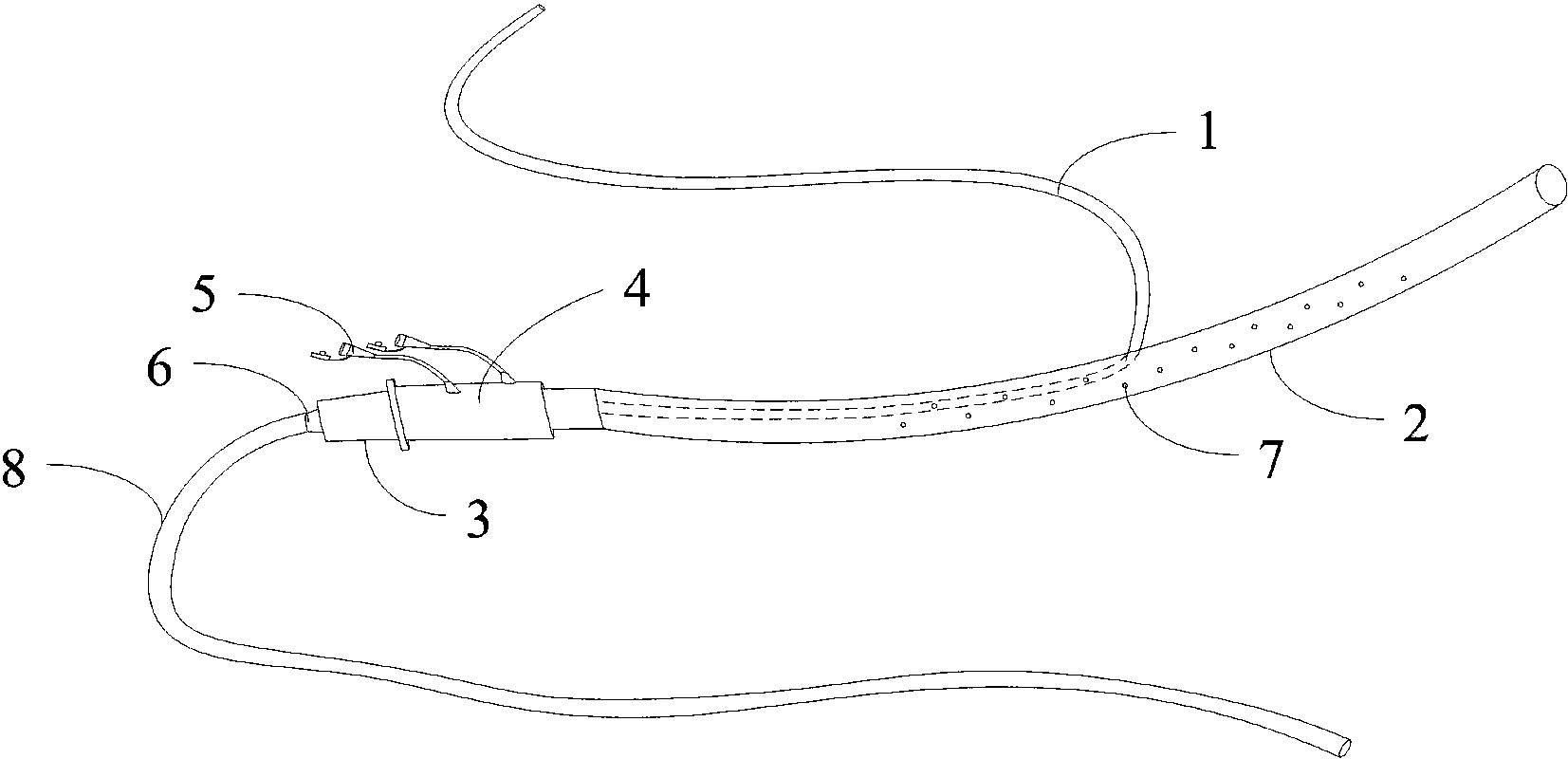 cn207400952u_一种双套管负压引流装置失效