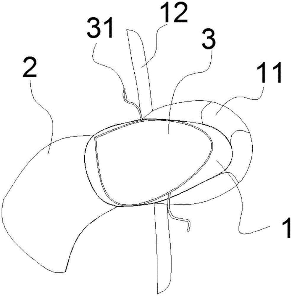 cn209596107u_一种新生儿水床式鸟巢有效