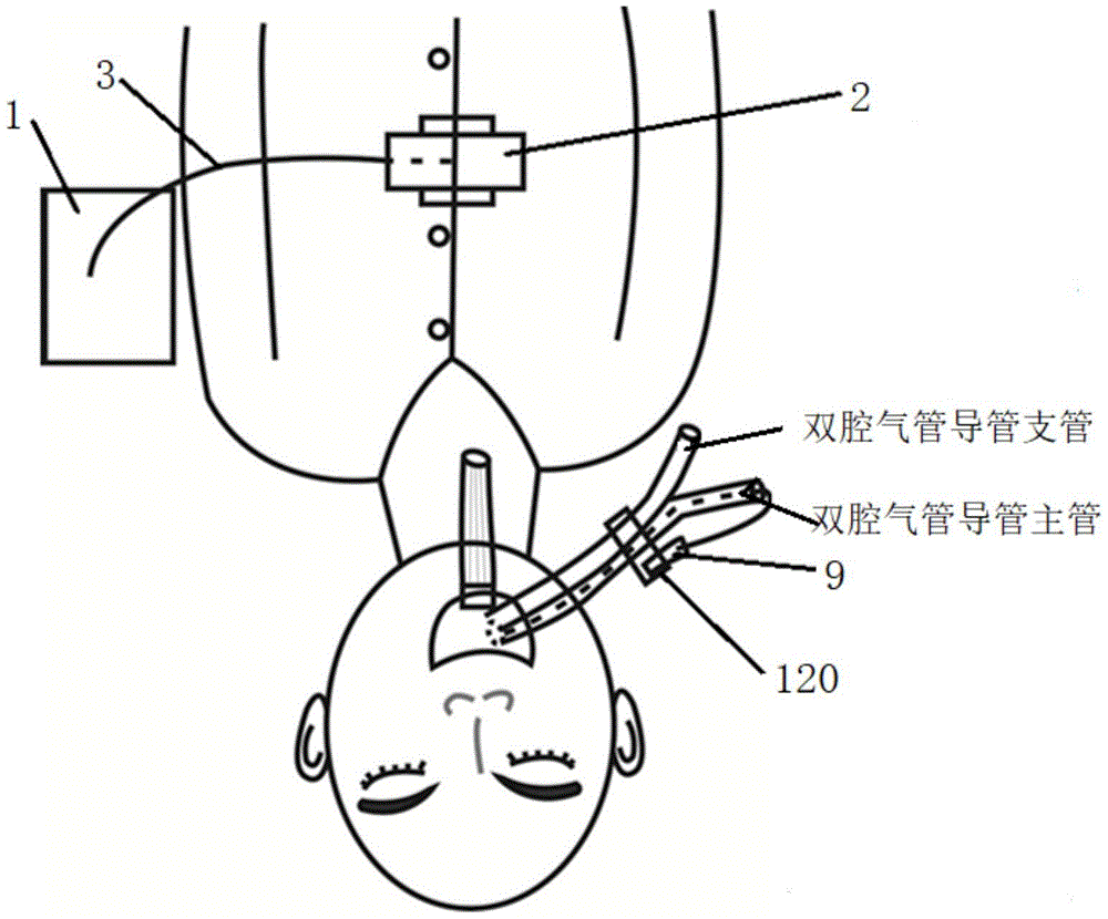 一种可视性即时性双腔气管插管操作组件