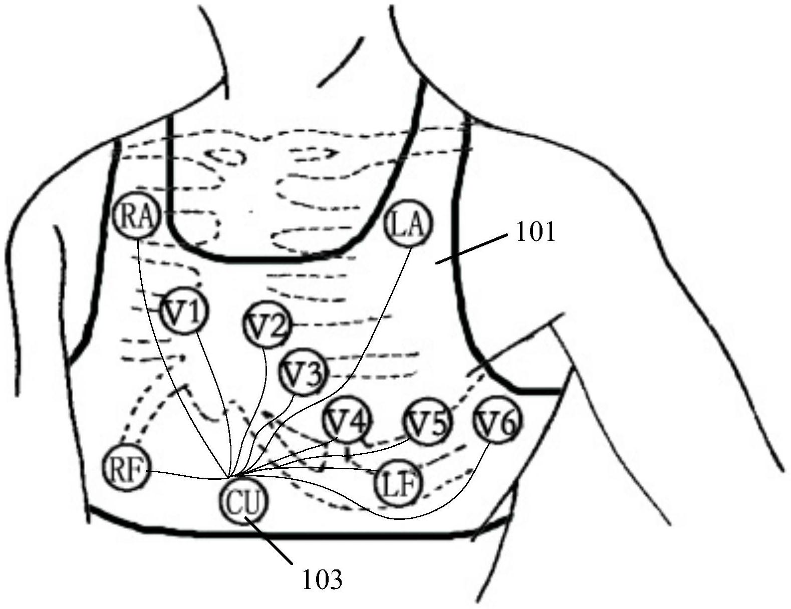 十二导联可穿戴心电监护智能内衣