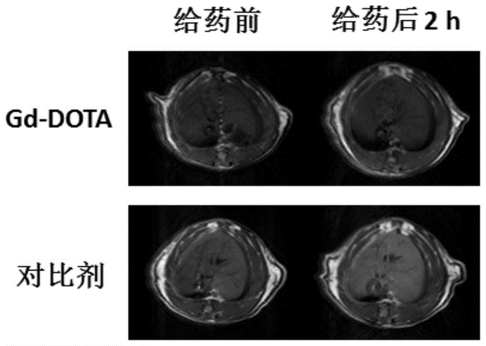 cn107445911b_一种二核含钆磁共振对比剂及其制备与应用