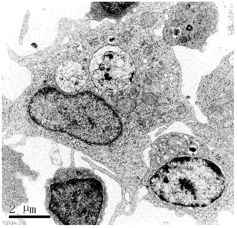 一种大黄鱼头肾巨噬细胞体外模型的构建技术,其特征是利用31%/45%梯度