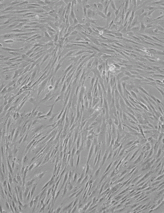 人脐带血富血小板裂解液培养自体脐带间充质干细胞方法