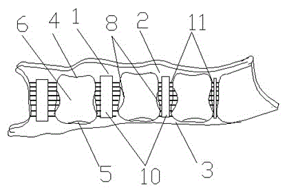 cn105125327a_脚趾矫正仪失效