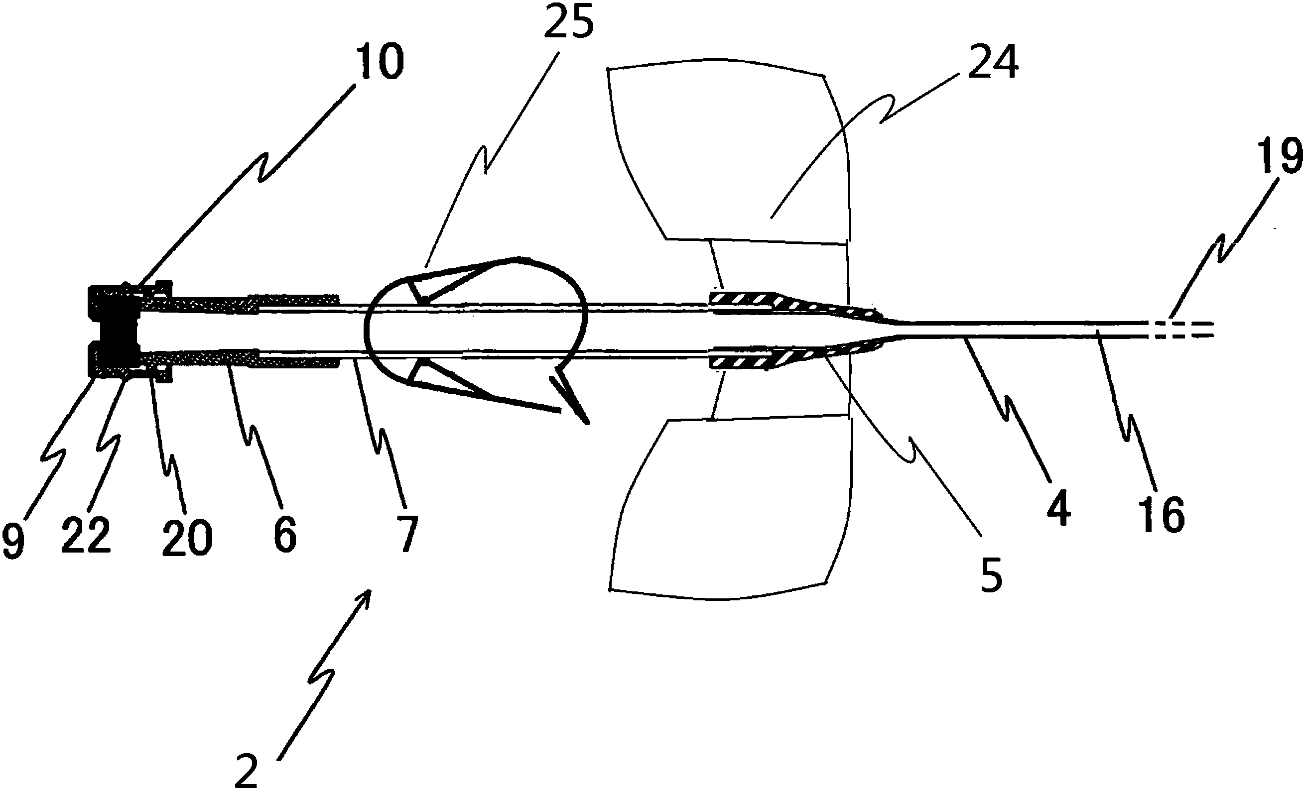 cn109045401a_一种动静脉内瘘套管留置针在审