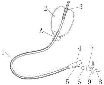 本发明涉及产后止血器具领域,尤其涉及一种产后宫腔止