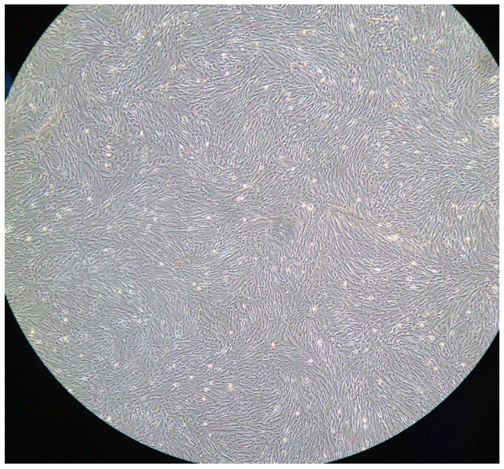 一种脐带间充质干细胞的分离培养方法