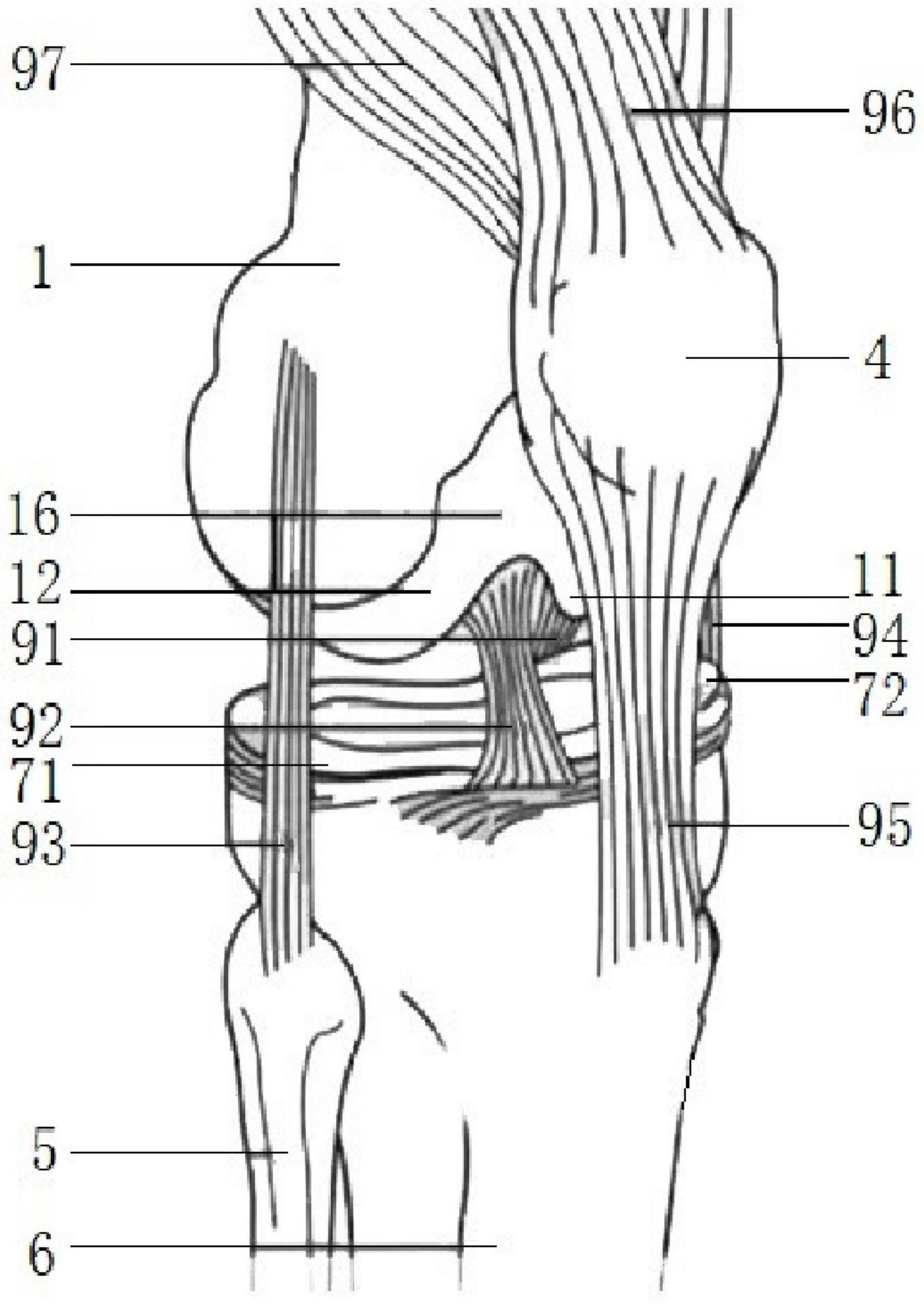 一种保留后交叉韧带的解剖型膝关节胫骨平台垫