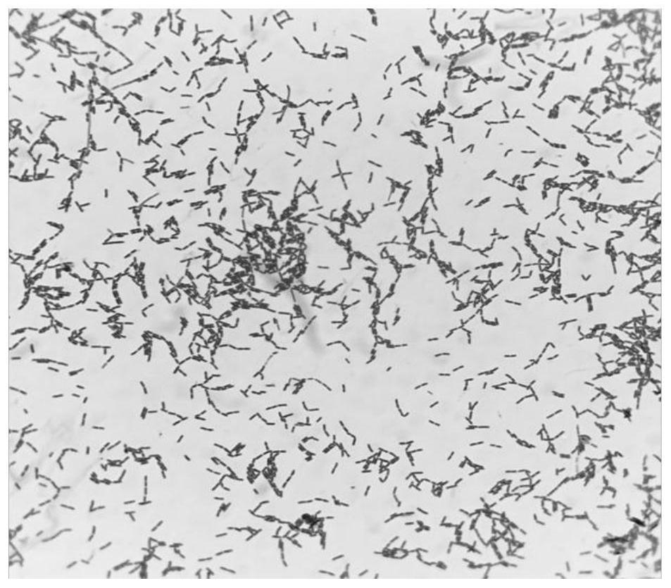 副干酪乳杆菌及其在制备治疗溃疡性结肠炎药物中的应用