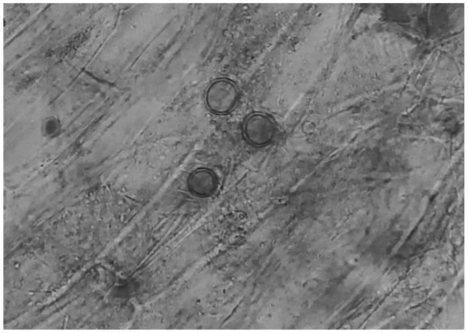 pindica厚垣孢子pindica孢子菌剂及其制备方法