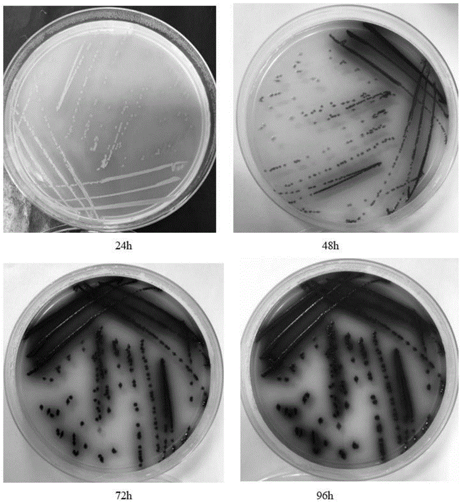 cn111996154a_枯草芽孢杆菌黑色变种培养基及其制备方法与应用在审