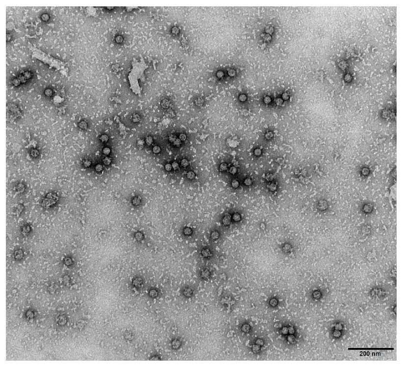 一种肠道病毒ev71型病毒样颗粒编码基因表达载体重组酵母菌及制备方法