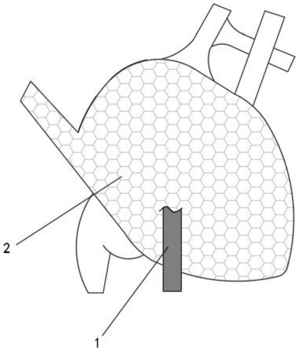cn112843475a_一种用于幼儿的心脏起搏器在审