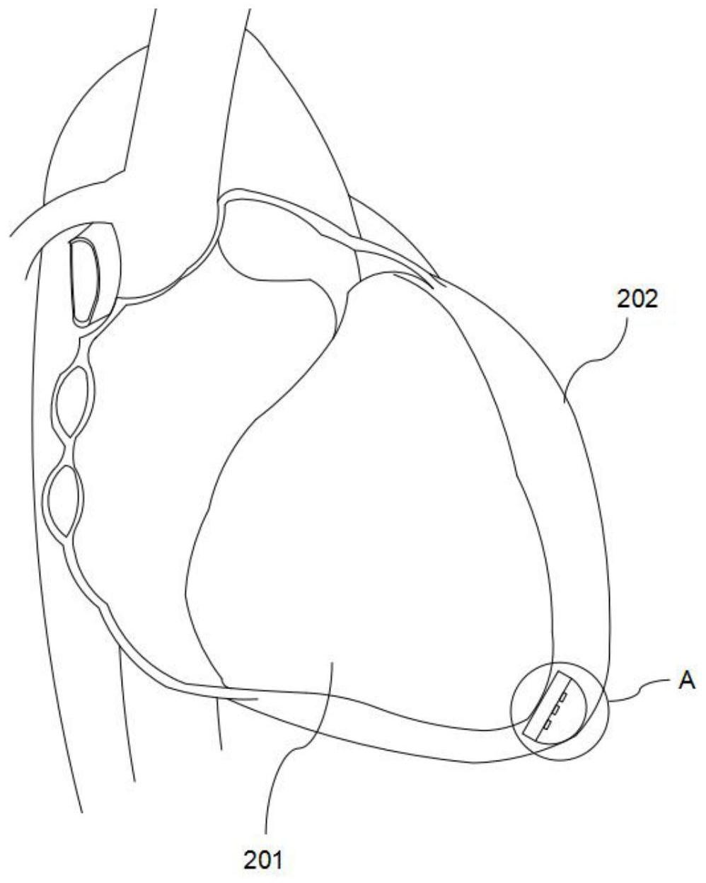 一种植入式生物能供电系统