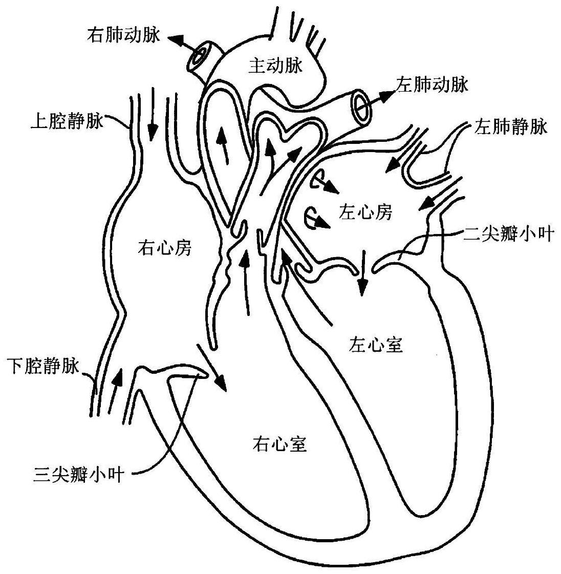 一种防返流多功能心脏瓣膜假体