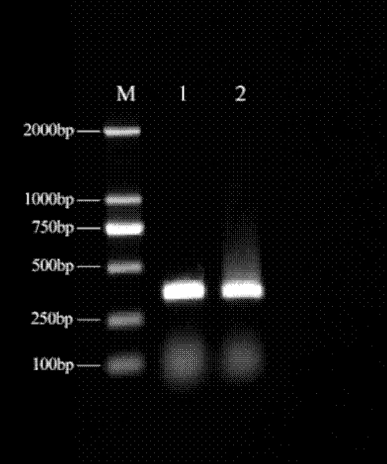是指一种新的中华鲟天然抗菌肽pen-hepcidin和编码该基因的氨基酸序列