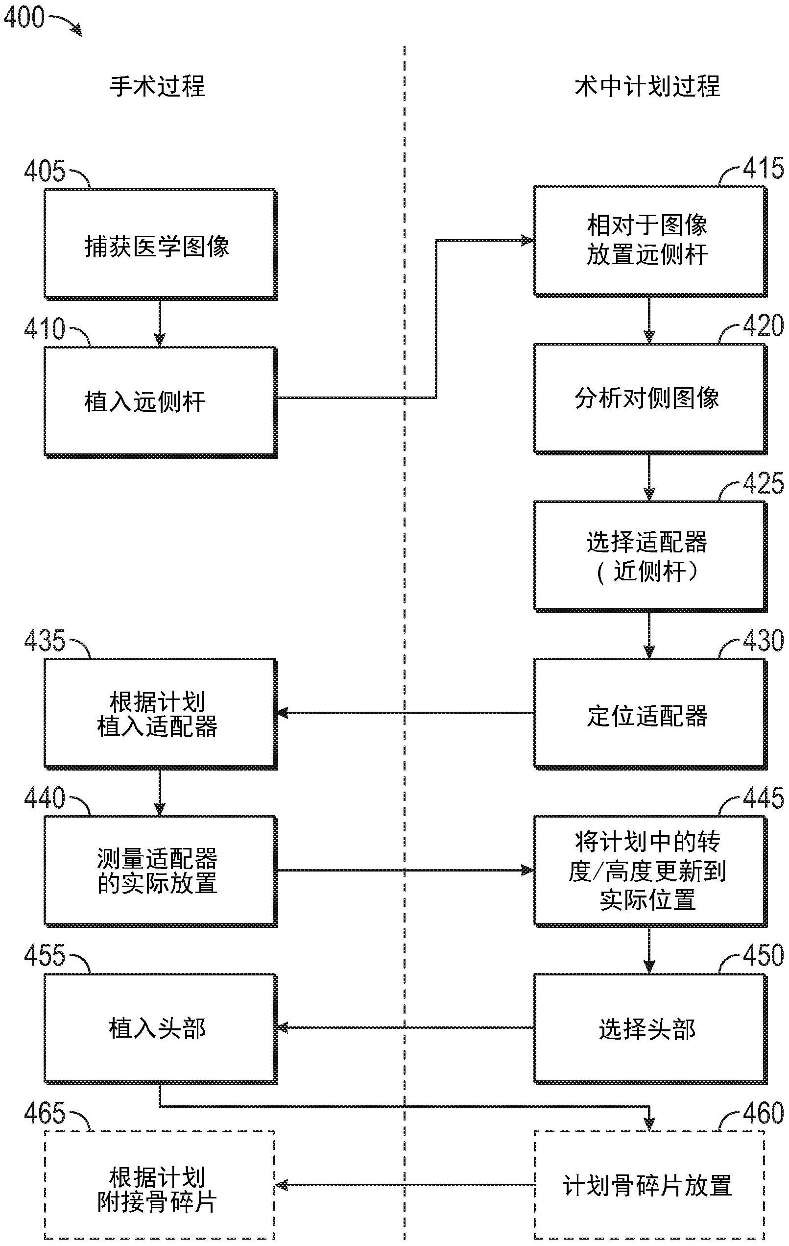 cn109475385b_用于术中手术计划的系统和方法有效