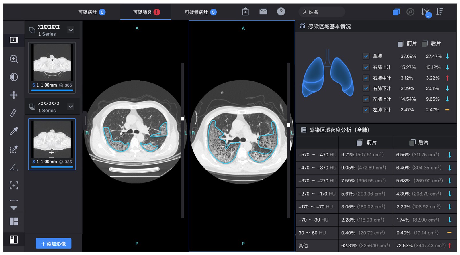 用于屏幕面板的医疗影像诊断图形用户界面