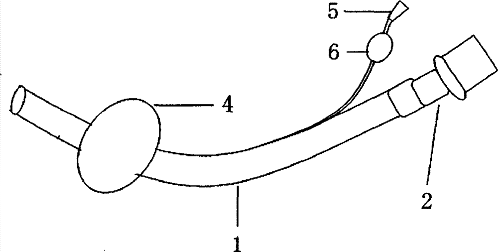 气管套管结构图片