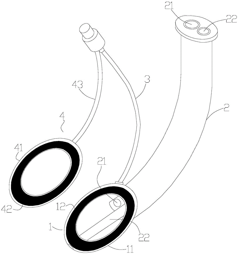 本实用新型涉及一种新型喉罩,包括罩囊结构,喉管,充气管和对位件,罩囊