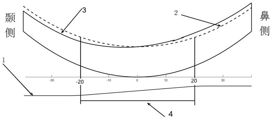 一种附加有内置式棱镜的渐进多焦点眼镜片