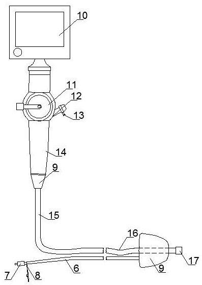 肺段切除术的膨肺器及包含该膨肺器的纤支镜,膨肺器为双层的空腔结构