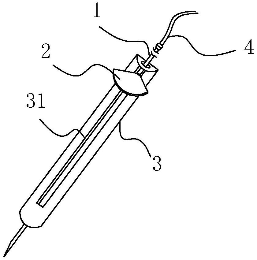 一种新型头皮针