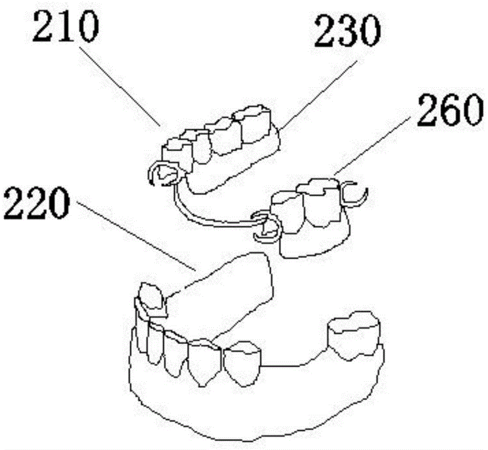 用过渡层二次精细修复义齿结构