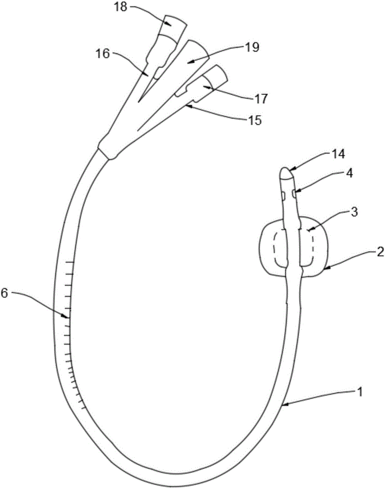 三腔导尿管的结构图解图片