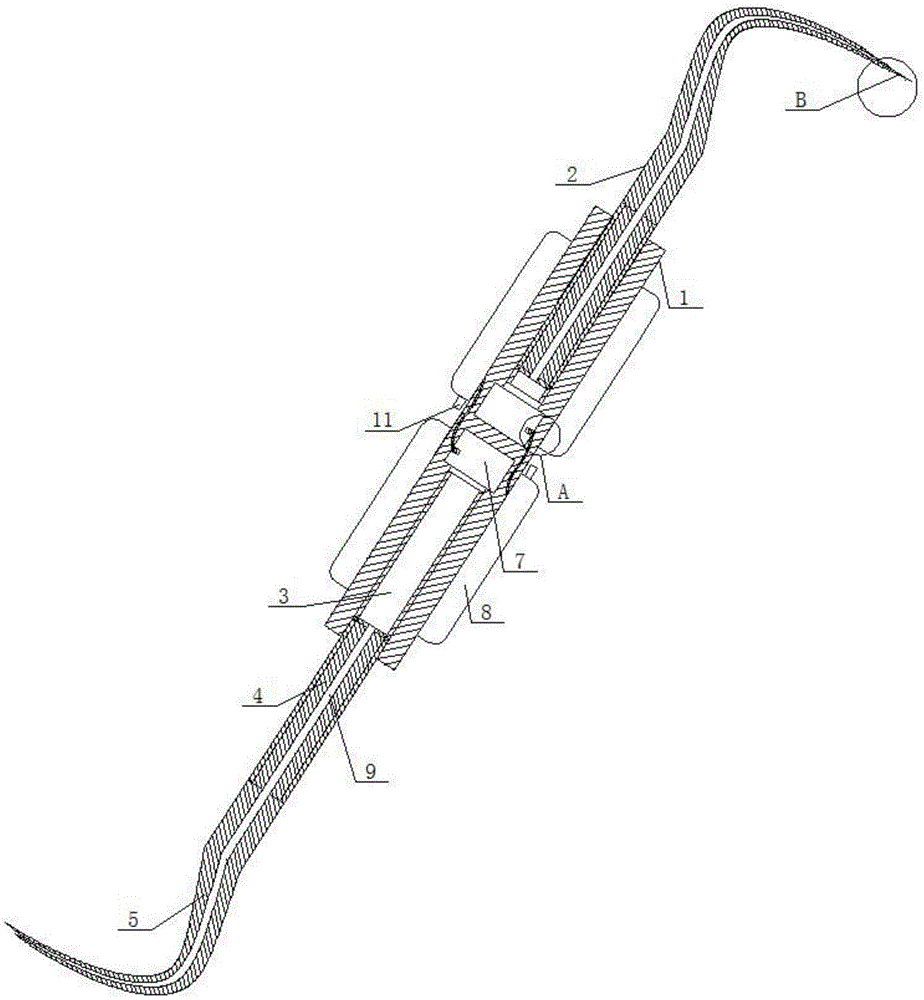 cn208958372u_一種排齦器